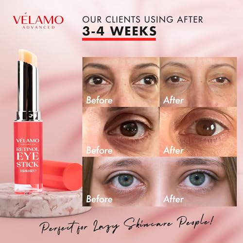 Retinol Eye Products for Anti-Aging and Brightening