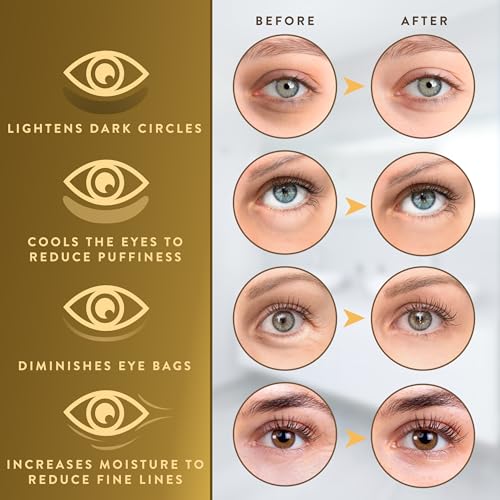 24K Gold Eye Patches for Puffy Dark Circles