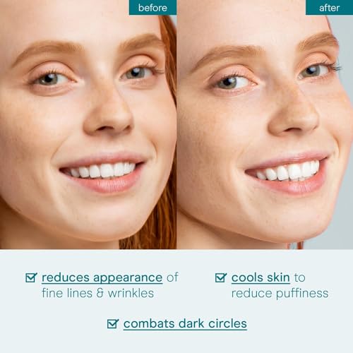 Cooling Eye Gel for Dark Circles & Puffiness