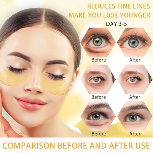 24K Gold Under Eye Patches for Puffiness & Dark Circles