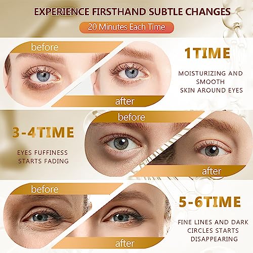 60 Pcs 24K Gold Under Eye Patches Pair
