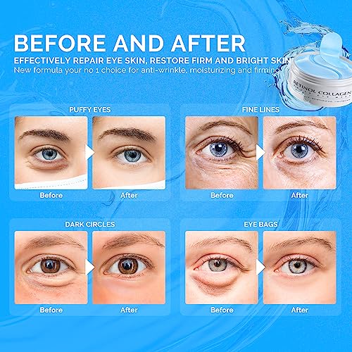 Enaskin Naturals Retinol Eye Gel Patches - 30 Pairs