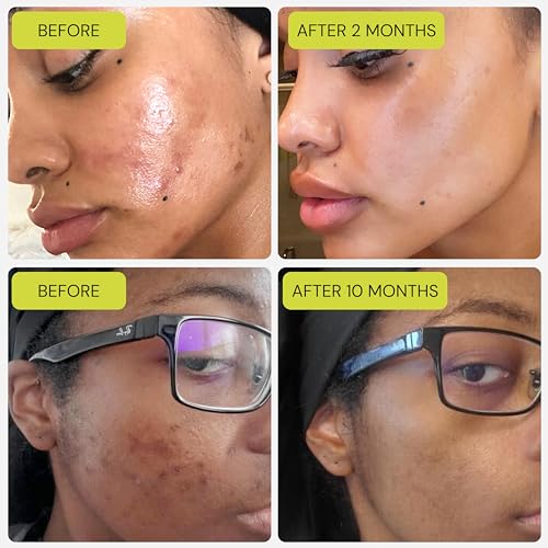 Gleamin Vitamin C Clay Mask - 10-Minute Facial