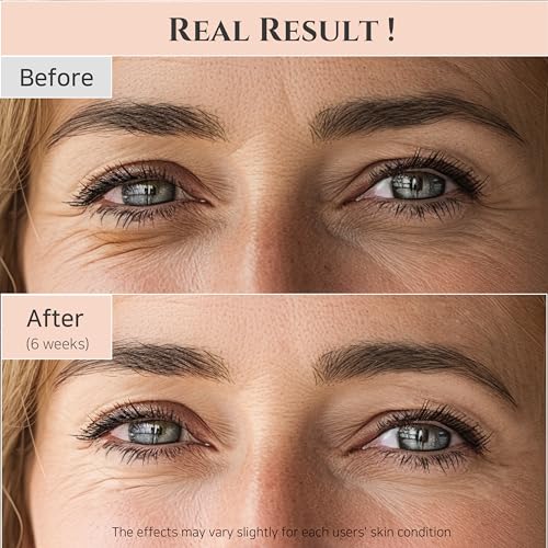 Joseon Revive Eye Serum with Retinal for Brighter Eyes