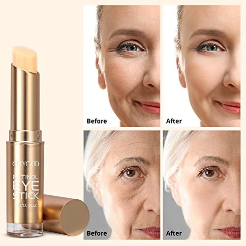 Collagen Retinol Eye Stick reduces dark circles, wrinkles