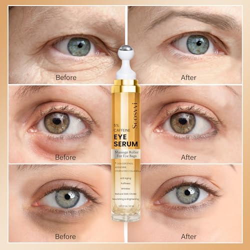 Dark Circle Eye Serum with 5% Caffeine & Ice Roller
