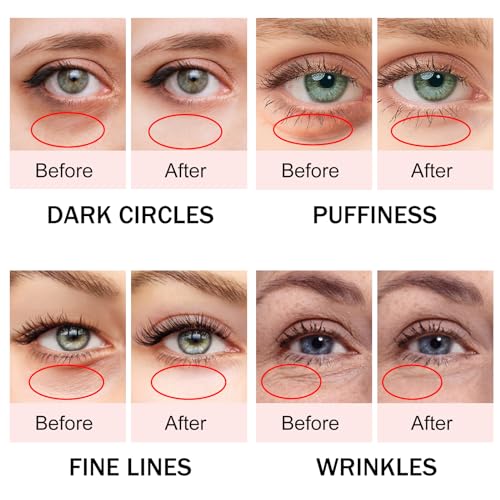 Eye Cream for Dark Circles & Puffy Eyes