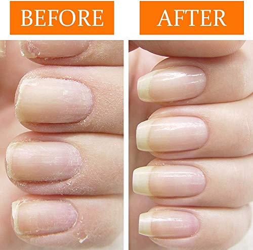 Nail Tek Damaged Nails Repair Kit: Intensive Therapy, Foundation & Renew