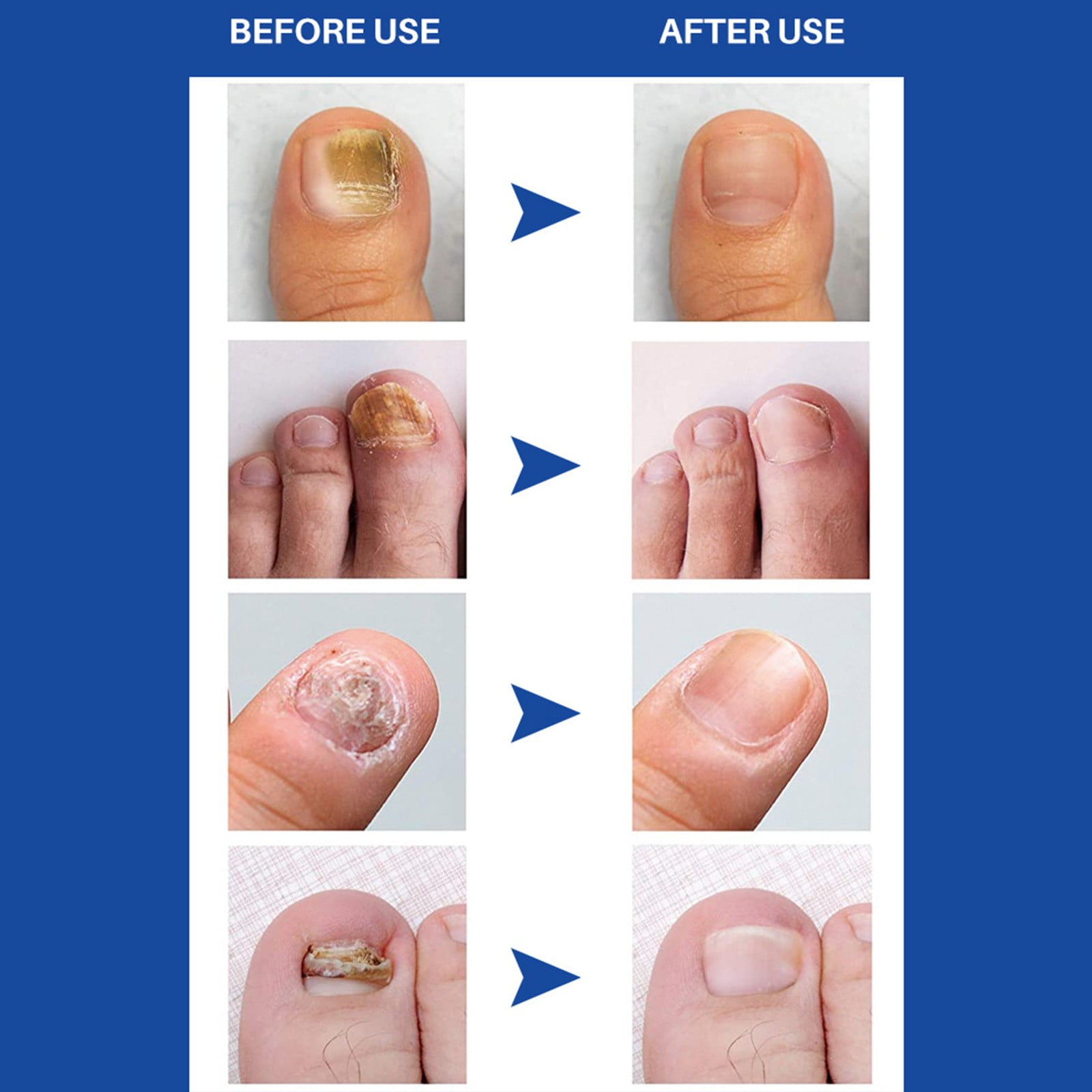 Intensive Nail Care Lotion with Keratin and Vitamin E