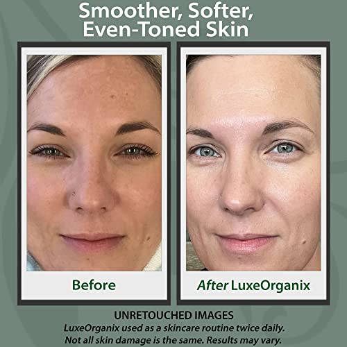 LuxeOrganix Organic Vitamin C Face Moisturizer - Anti-Aging