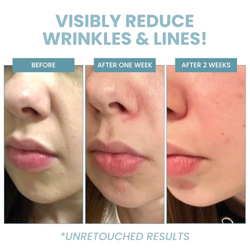 Eva Naturals Retinol Serum with Hyaluronic Acid - Anti Aging Formula for Face