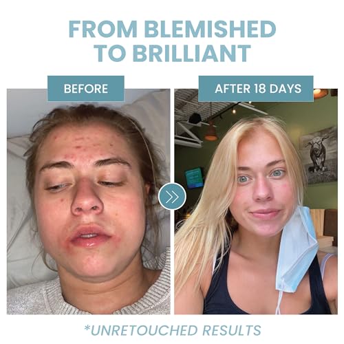 Eva Naturals Retinol Serum with Hyaluronic Acid - Anti Aging Formula for Face