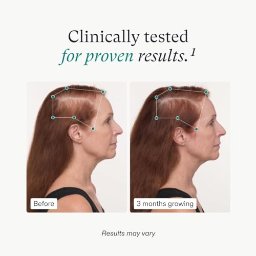 Women's Balance Hair Growth Supplements - Clinically Proven