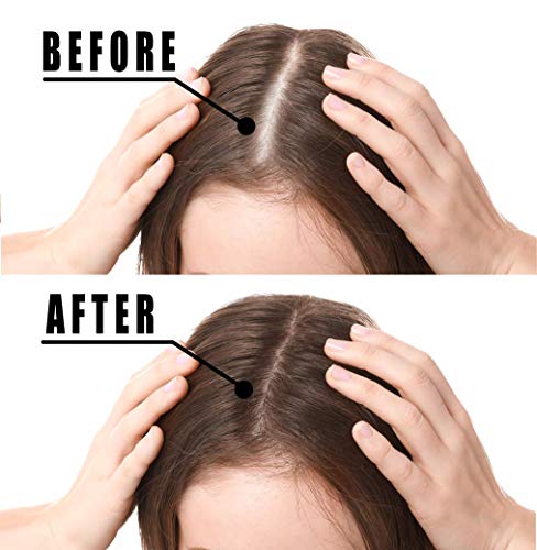 VOTALA Hair Growth Serum: Promotes Thicker, Stronger Hair