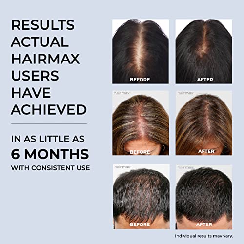 Hairmax RegrowMD Laser Hair Growth Cap