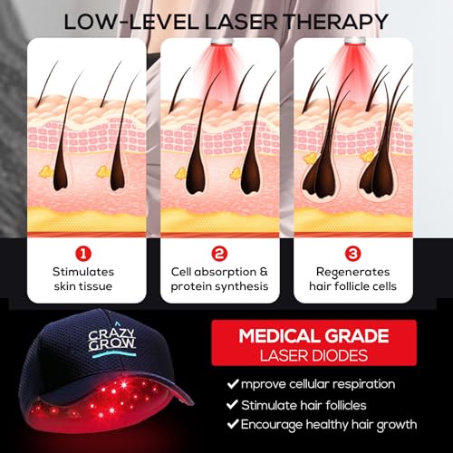 Hair Growth Cap: Laser Therapy for Hair Loss