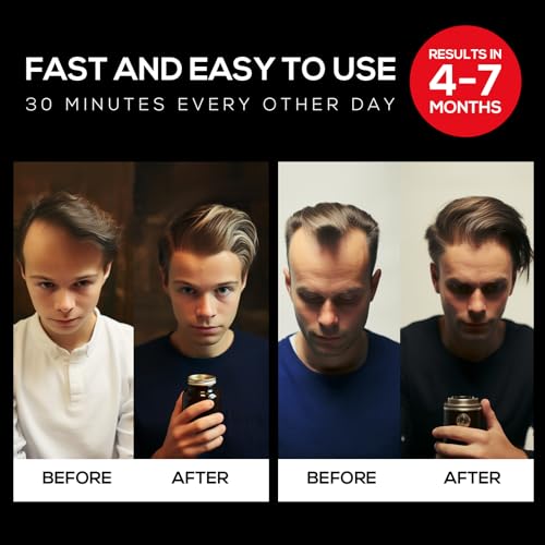 Hair Growth Cap: Laser Therapy for Hair Loss