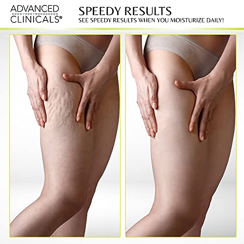 Green Coffee Bean Firming Body Cream for Butt