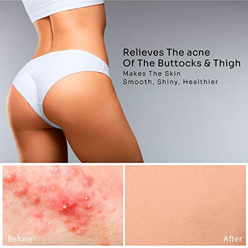 Hydrating Butt Lotion with Plant Extracts for Acne