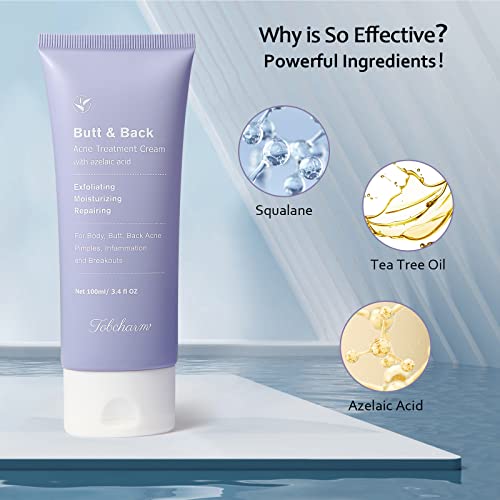 Tobcharm Acne Treatment for Back, Butt, Body - 3.4 fl. oz