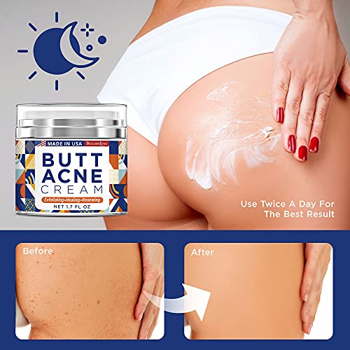 BellamiLuxx Butt & Thigh Acne Clearing Cream 1.7oz