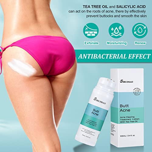 Butt Acne Clearing Treatment (3.5 OZ) - Zits, Pimples