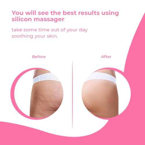 AVALON CARE Cellulite Massager Roller - Anti Cellulite Brush