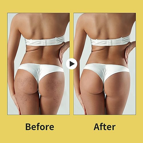 Bikini Area Exfoliating Body Scrub, Brightening Bump Eraser