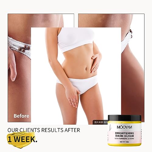 Bikini Area Exfoliating Body Scrub, Brightening Bump Eraser
