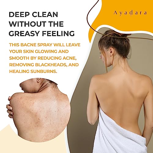 Ayadara Acne Treatment Body Spray for Butts