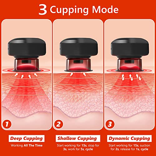 Smart Cupping Set with Red Light Therapy
