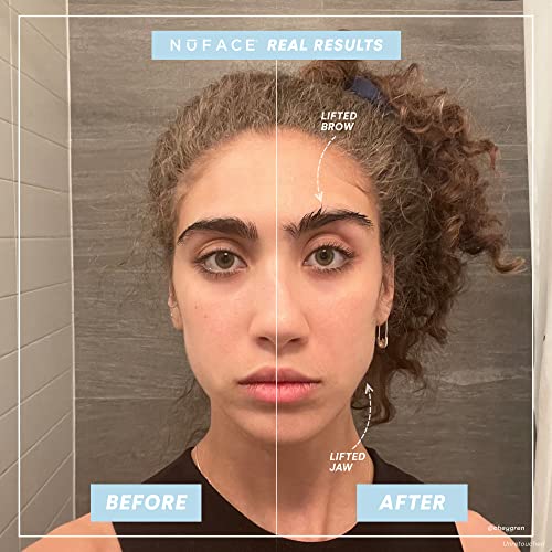 NuFACE Trinity Facial Toning Kit - Pro Results