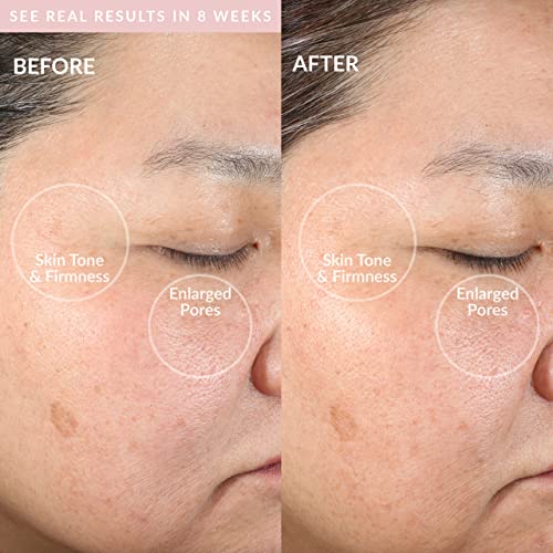 Smart facial cleansing & anti-aging device