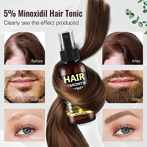 Minoxidil Hair Growth Spray for Thicker, Fuller Hair