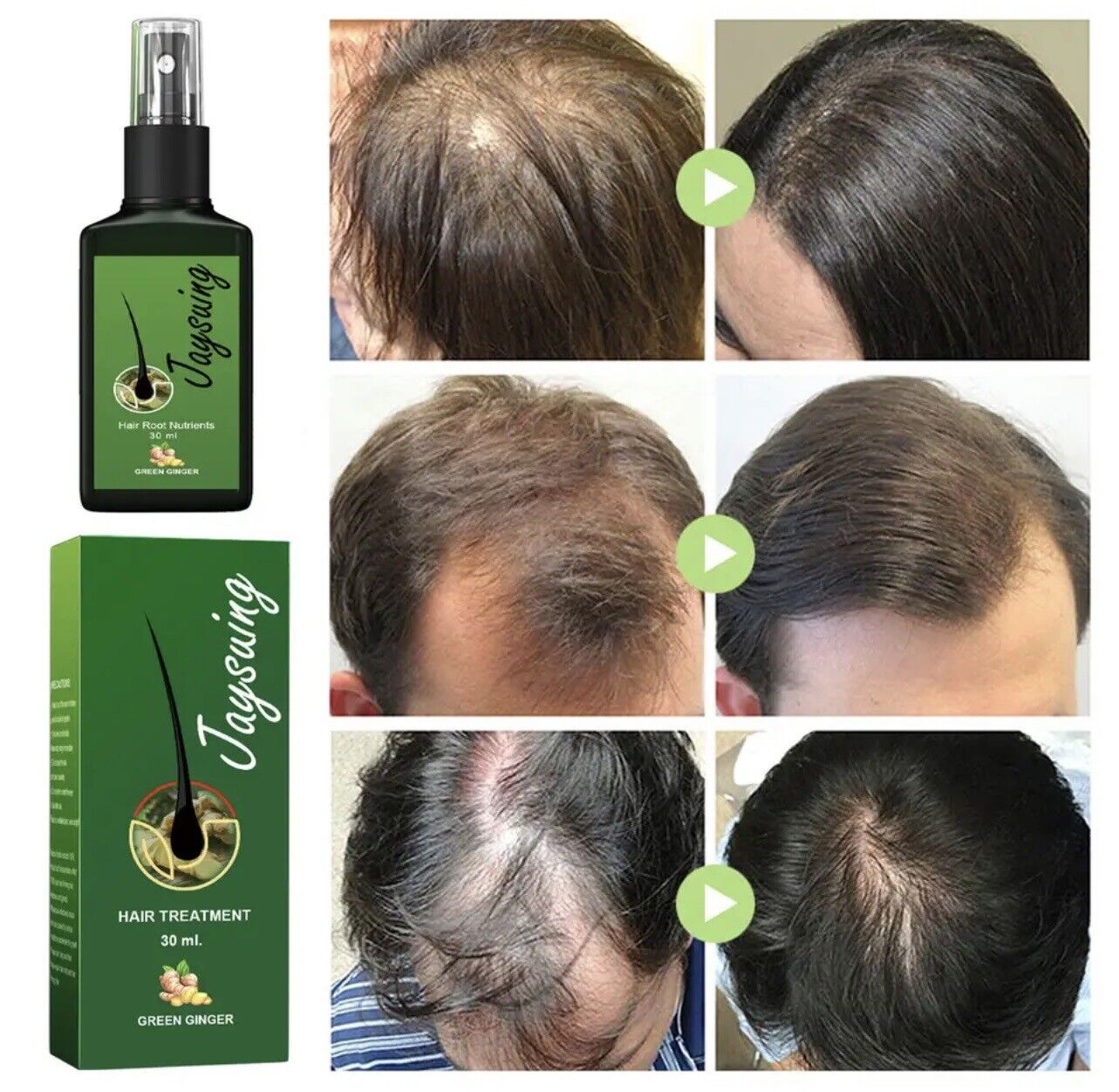 Hair loss solutions