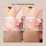 Aminzer 3-in-1 IPL Hair Removal Device