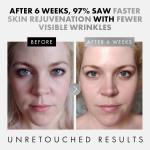 Eclat Skincare 3-Pack Face Serums for Youthful Skin